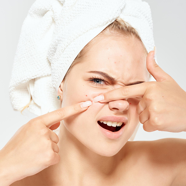 Acné : comment s'en débarrasser ? 19