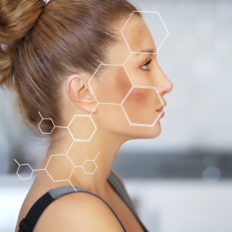 Eucerin : la solution pour lutter contre les taches pigmentaires 17