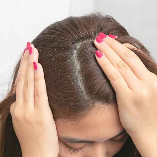 Cheveux (1)