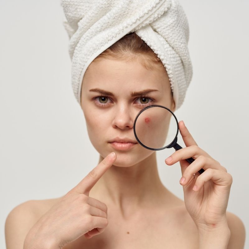 Comment stopper l’apparition des imperfections ? 1