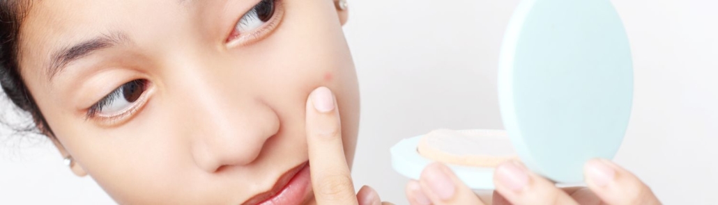 Acné : que faire pour éliminer les boutons d'acné ? 1