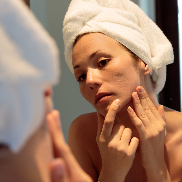 Comment éliminer les imperfections avec la gamme Effaclar ? 9