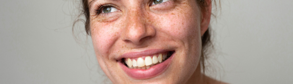 Taches brunes sur le visage : quelles en sont les causes et comment trouver des solutions ? 7