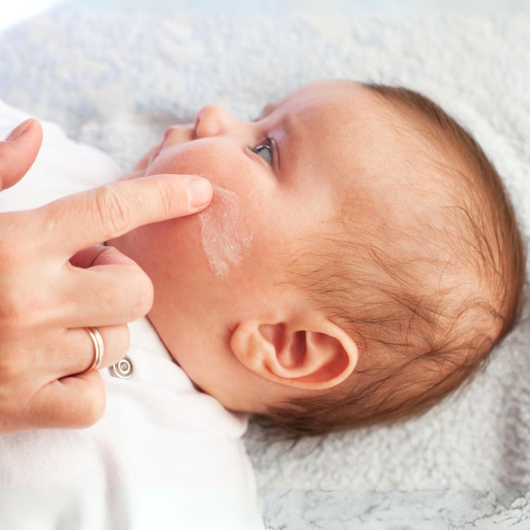 Eczéma du nourrisson : quels sont les symptômes, causes et traitements ? 7