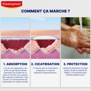 Pourquoi et comment utiliser un pansement Second Skin Protection ? 4