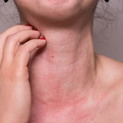 Top 6 des astuces pour lutter contre les allergies 1